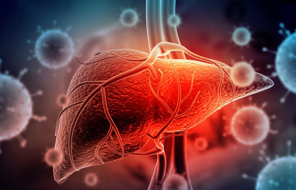 Ilustração 3D de um fígado atingido pela hepatite C