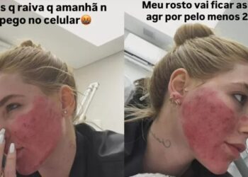 Virginia surpreende ao mostrar rosto após procedimentos estéticos