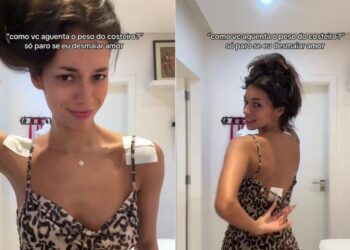 Alô Virginia! Alane posta vídeo de machucado no ombro pós desfile