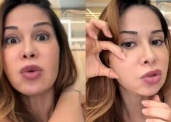 Com deformação, Maíra Cardi expõe cirurgia no rosto: “Gravíssimo”
