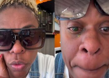 Cacau Protásio sofre perda de visão após uso de pomada capilar