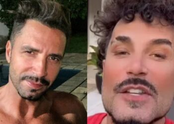 Latino choca ao aparecer com rosto todo harmonizado: “Nem parece”