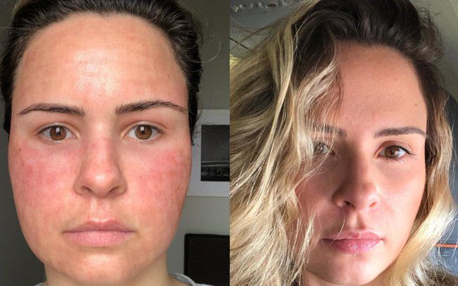 5fwcbparmli01nybkf2u926oz