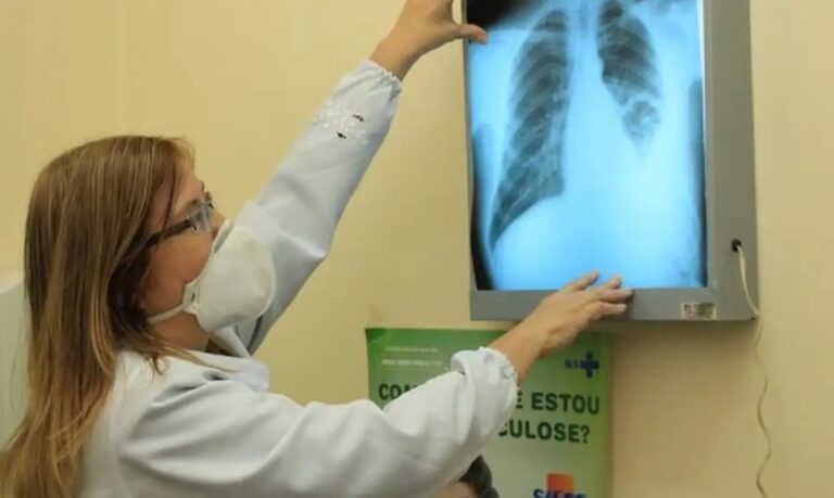 MinistriodaSaderepassaR100milhesparacombatetuberculoseem913municpios_0828505001779590619