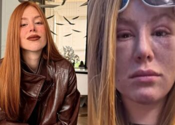 Mari Maria revela tumores abaixo dos olhos: “Achei que ia morrer”