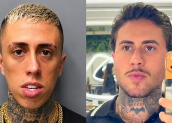 MC Daniel exibe novo rosto após intervenção estética; veja fotos