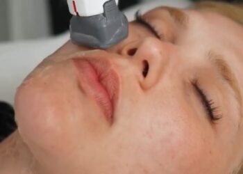 Aos 27 anos, Virginia faz procedimento para rejuvenescer o rosto