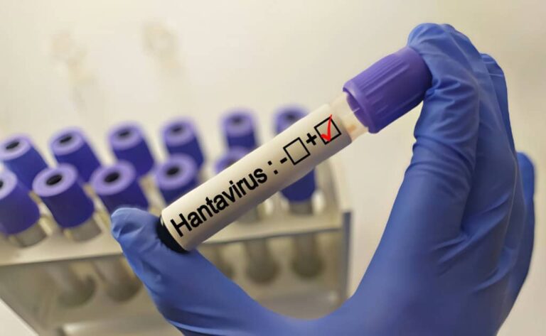 hantavirus-1024x630-1