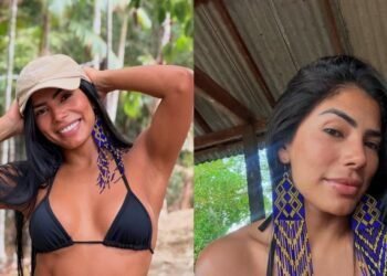 Marciele relata como quase ficou careca ao descobrir doença